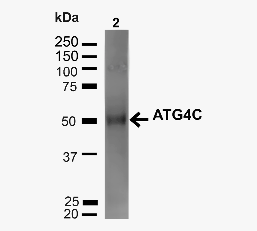 Western Blot - Arial Numbers, HD Png Download, Free Download