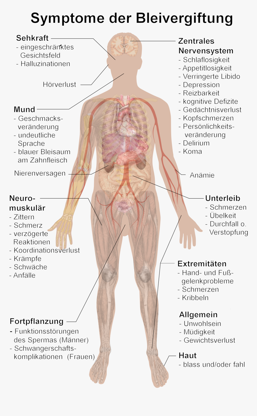 Symptome Bleivergiftung - Symptoms Of Lead Poisoning, HD Png Download, Free Download