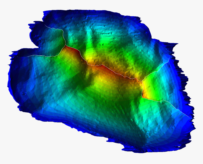 Individual Based Mitral Valve Finite Element Model - Art, HD Png Download, Free Download