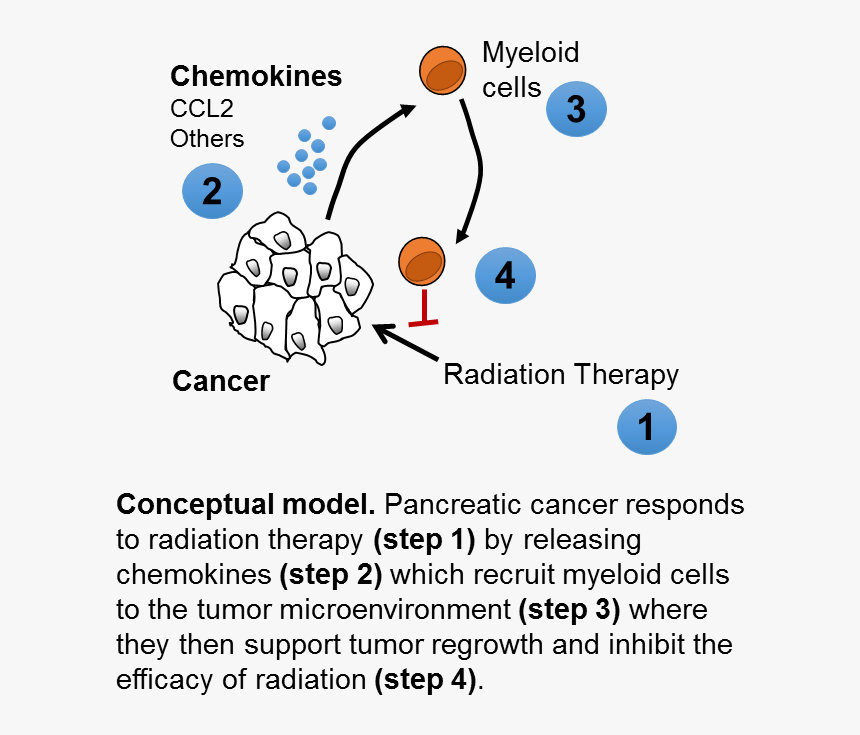 Penn Researchers Help Unravel Mysteries Of Pancreatic Ccr Pancreatic Cancer Hd Png Download