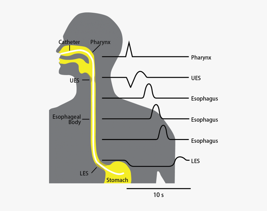 Esophageal Manometry - Esophageal Manometry Test, HD Png Download, Free Download